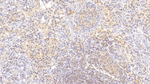 IL-2 Antibody in Immunohistochemistry (Paraffin) (IHC (P))
