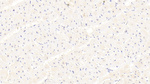 SRC3 Antibody in Immunohistochemistry (Paraffin) (IHC (P))