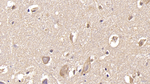 GluR2 Antibody in Immunohistochemistry (Paraffin) (IHC (P))