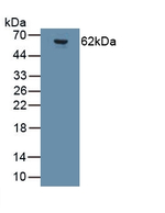 GluR2 Antibody in Western Blot (WB)
