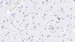 NMDAR2B Monoclonal Antibody (C4)