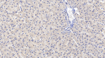 EB1 Antibody in Immunohistochemistry (Paraffin) (IHC (P))