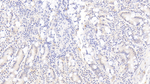 RAC1 Monoclonal Antibody (C1)