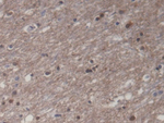 Creatine Kinase MM Antibody in Immunohistochemistry (Paraffin) (IHC (P))