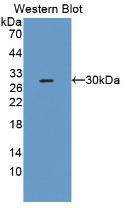 SERPINB2 Antibody in Western Blot (WB)