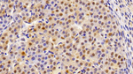 Thioredoxin 1 Antibody in Immunohistochemistry (Paraffin) (IHC (P))