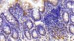 Thioredoxin 1 Antibody in Immunohistochemistry (Paraffin) (IHC (P))