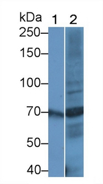 CAT1 Antibody in Western Blot (WB)