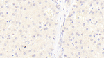 LRP6 Monoclonal Antibody (C3)