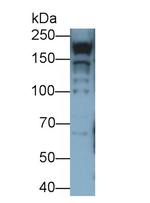 MYH7 Antibody in Western Blot (WB)