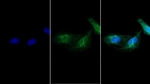MYH8 Monoclonal Antibody (D3)