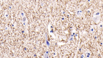 BAI3 Antibody in Immunohistochemistry (Paraffin) (IHC (P))