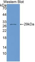 FKBP8 Antibody in Western Blot (WB)