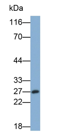 GSTA3 Monoclonal Antibody (9#)