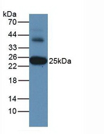 GSTA3 Antibody in Western Blot (WB)