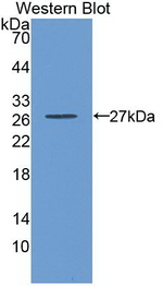 GSTA3 Antibody in Western Blot (WB)