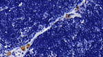 TLR2 Antibody in Immunohistochemistry (Paraffin) (IHC (P))
