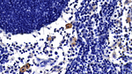 TLR2 Antibody in Immunohistochemistry (Paraffin) (IHC (P))