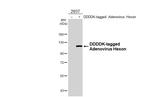 Adenovirus Hexon Antibody in Western Blot (WB)