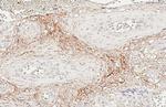 ENPP2 Antibody in Immunohistochemistry (Paraffin) (IHC (P))