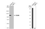 CASK Antibody in Western Blot (WB)