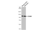 CASK Antibody in Western Blot (WB)