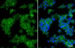 CCR1 Recombinant Rabbit Monoclonal Antibody (HL2840)