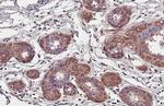 CCR1 Antibody in Immunohistochemistry (Paraffin) (IHC (P))