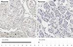 CCR1 Antibody in Immunohistochemistry (Paraffin) (IHC (P))