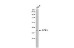 CCR1 Antibody in Western Blot (WB)