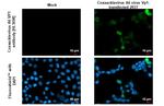 Coxsackievirus A6 VP1 Recombinant Rabbit Monoclonal Antibody (HL3698)