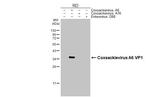 Coxsackievirus A6 VP1 Antibody in Western Blot (WB)