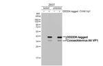 Coxsackievirus A6 VP1 Antibody in Western Blot (WB)