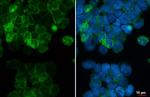 CXCR4 Antibody in Immunocytochemistry (ICC/IF)