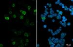 CXCR6 Antibody in Immunocytochemistry (ICC/IF)