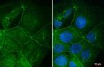 Desmocollin 2 Antibody in Immunocytochemistry (ICC/IF)