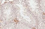 DHCR7 Antibody in Immunohistochemistry (Paraffin) (IHC (P))
