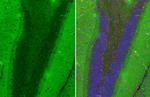 ZPK Antibody in Immunohistochemistry (Paraffin) (IHC (P))