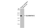 ZPK Antibody in Western Blot (WB)