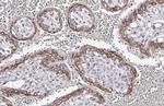FSHR Recombinant Rabbit Monoclonal Antibody (HL2841)