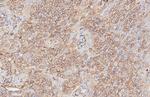 HLA-DQ Recombinant Rabbit Monoclonal Antibody (HL3409)