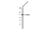 Klotho Antibody in Western Blot (WB)