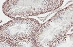 Lamin B1 Antibody in Immunohistochemistry (Paraffin) (IHC (P))