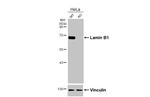 Lamin B1 Antibody in Western Blot (WB)