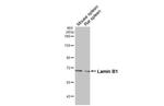 Lamin B1 Antibody in Western Blot (WB)