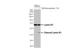 Lamin B1 Antibody in Western Blot (WB)