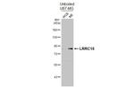 LRRC15 Recombinant Rabbit Monoclonal Antibody (HL3750)