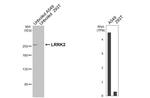 LRRK2 Antibody in Western Blot (WB)