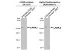 LRRK2 Antibody in Western Blot (WB)
