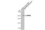 LRRK2 Antibody in Western Blot (WB)